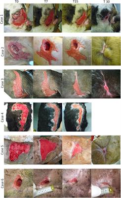 Autologous Platelet-Rich Plasma Enhances the Healing of Large Cutaneous Wounds in Dogs